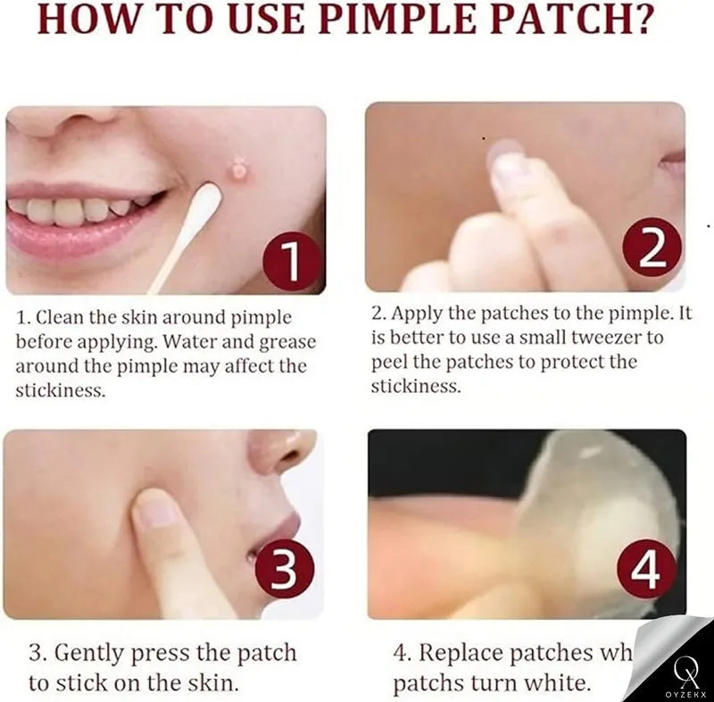 Pimple Patch For Face